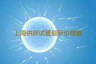 上海供卵试管最新价格查询,上海助孕中介名称大全